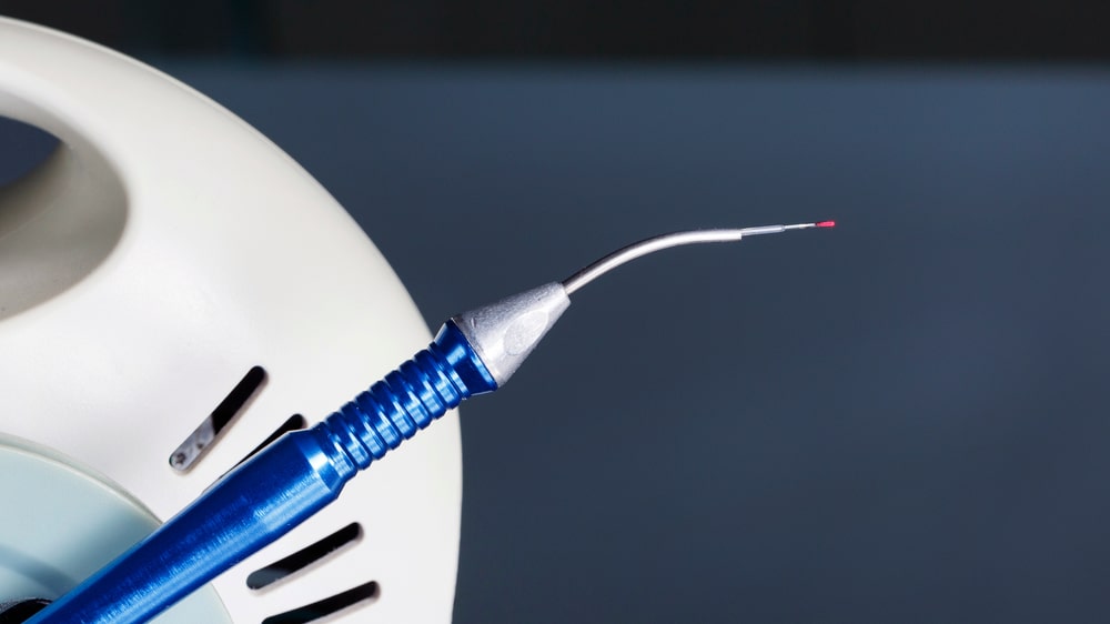 La technologie laser utilisée en dentisterie